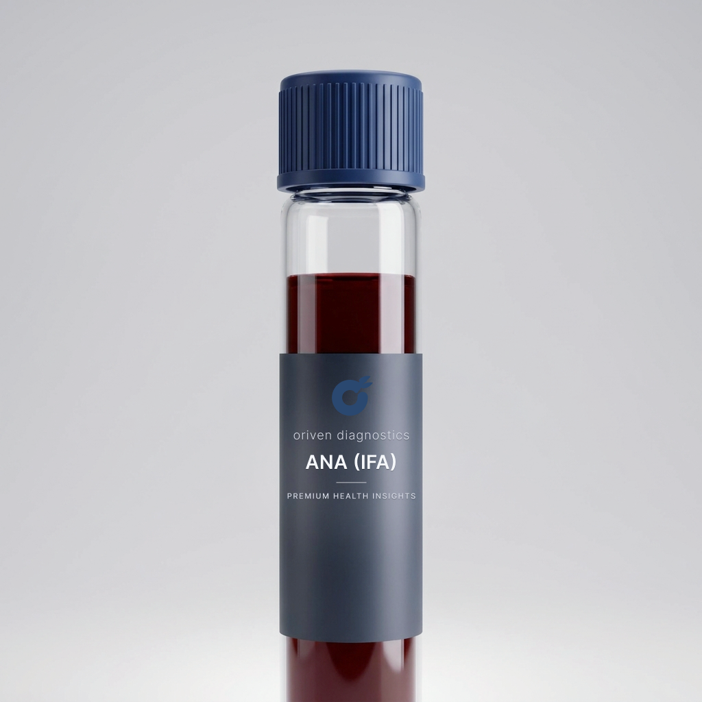 Antinuclear Antibodies (ANA), IFA