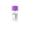 Antinuclear Antibodies (ANA), IFA