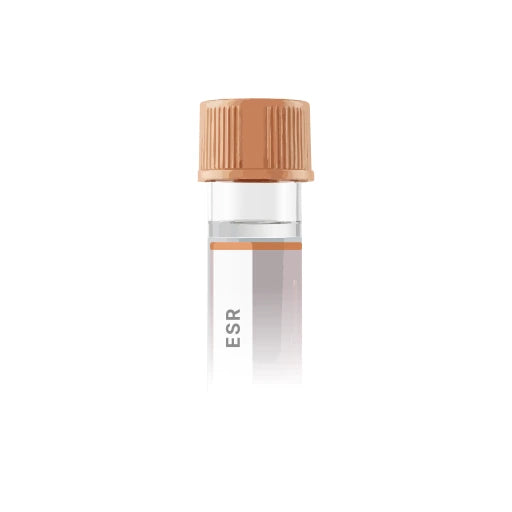 Erythrocyte Sedimentation Rate (ESR) - Westergren