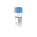 Hereditary Hemochromatosis (HFE), DNA Analysis