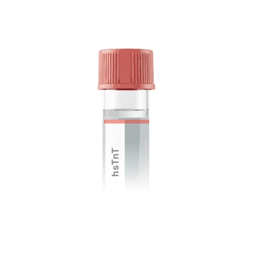 High Sensitive Troponin T (hsTnT)