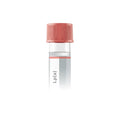 Lipoprotein(a) (Lp(a))