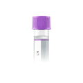 Luteinizing Hormone (LH)