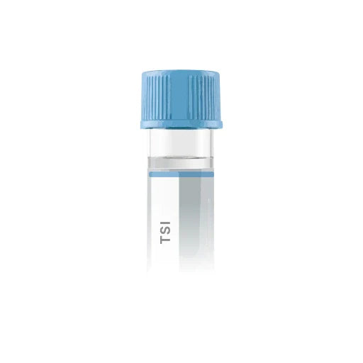 Thyroid-stimulating Immunoglobulin (TSI)