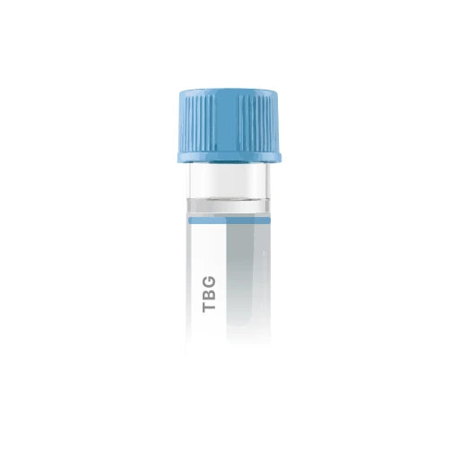 Thyroxine Binding Globulin (TBG)